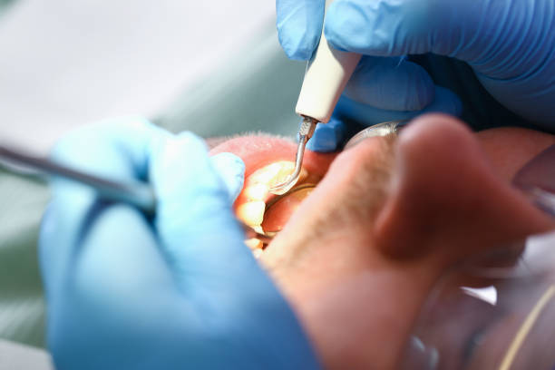 Best Emergency Dental Services for Seniors in Mason City, IL