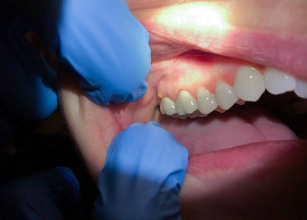 Best Weekend Emergency Dentist in Mason City, IL