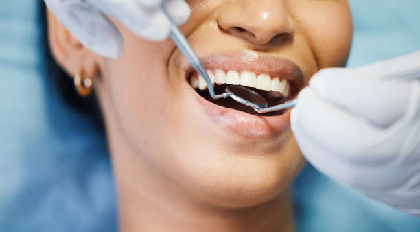 Best Orthodontic Emergency Dentist in Mason City, IL