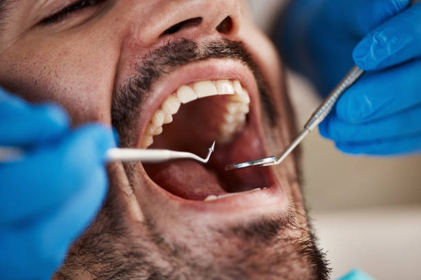 Best Mobile Emergency Dentist in Mason City, IL